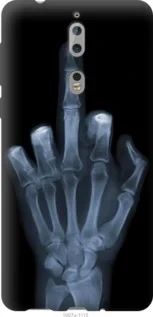 Чохол для Nokia 8 з силікону FCh_061944