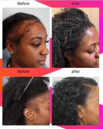 Капсули для росту волосся Sevich Chebe Hair Growth Capsule, 30 шт | Зображення 3