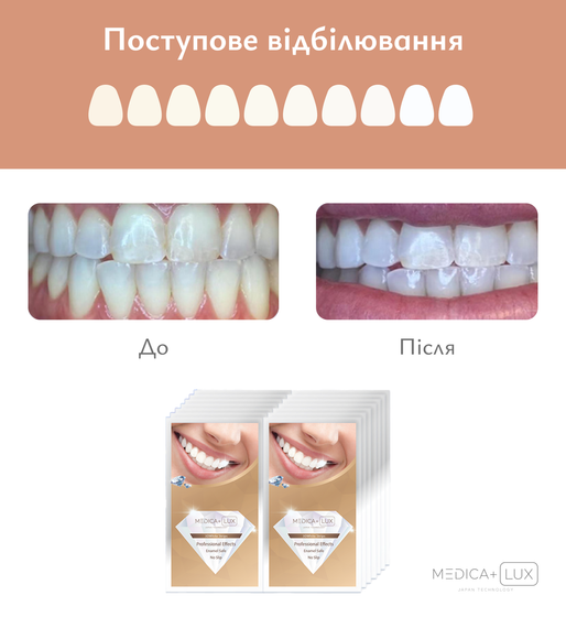 Відбілювальні смужки MEDICA+ 3DWhite Strips | Зображення 3