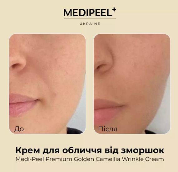 Крем для лица от морщин Medi-Peel Premium Golden Camellia Wrinkle Cream (50 g) | Зображення 2