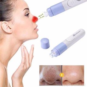 Вакуумний очищувач SPOTCLEANER Face Pore Cleaner вакуумний очищувач пор обличчя KQ-38
