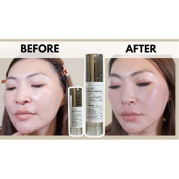 Сироватка-бустер з мікроголками VT Cosmetics Reedle Shot 300 (50 ml) | Зображення 2