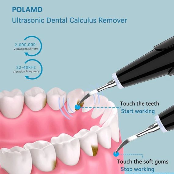 Ультразвуковой скалер для удаления зубного налета, портативный, черный | Зображення 2