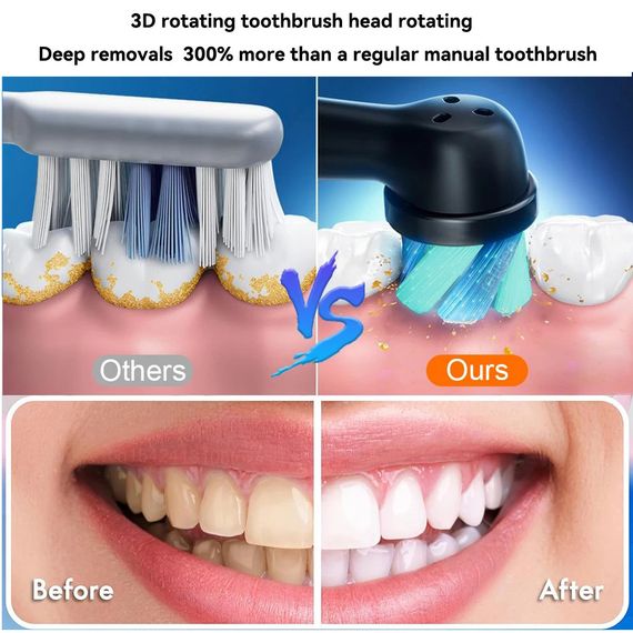 Електрична зубна щітка з 4 змінними насадками, USB-перезаряджання, таймер. Рожева | Зображення 5