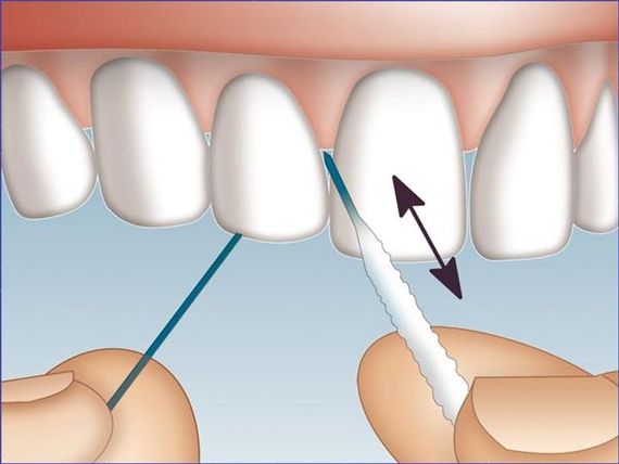 Флос Miradent Mirafloss Implant CHX Medium (2,2 mm) бірюзовий | Зображення 1