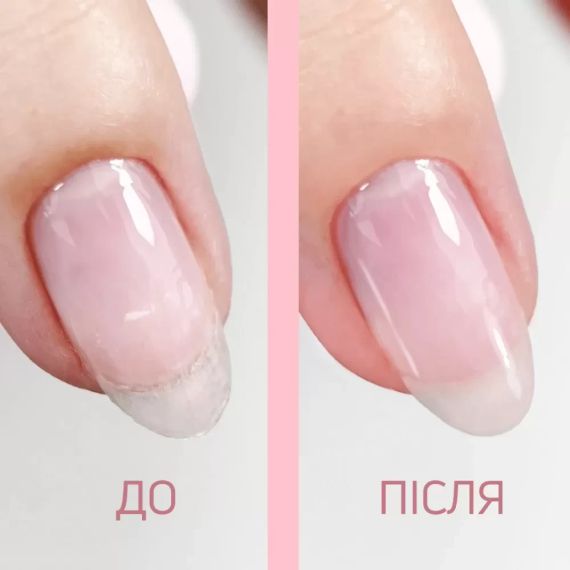 Засіб для зміцнення нігтів JOIA vegan Nail Therapy 15мл | Зображення 1