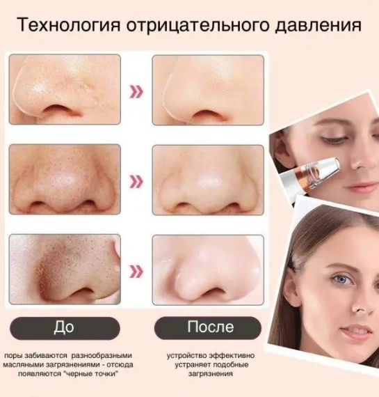 Вакуумный очиститель кожи и пор Multi-Functional для чистки лица | Зображення 1