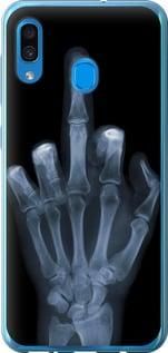 Чехол на Samsung Galaxy A20 2019 A205F Рука через рентген из пластика FCh_047912