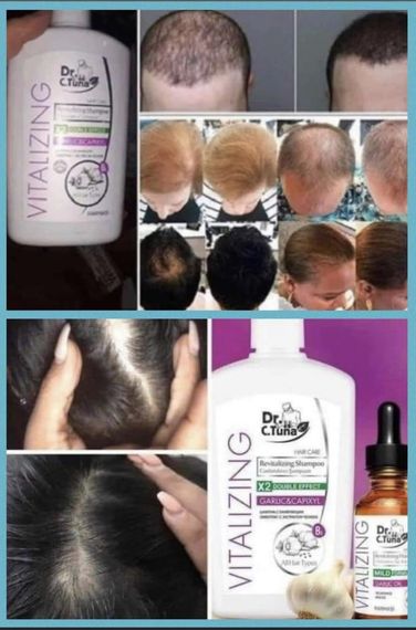 Набор против выпадения и укрепления волос (шампунь, маска, концентрат) Farmasi Vitalizing Dr. C.Tuna | Зображення 4