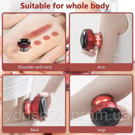 Електричний вакуумний масаж | Масажер для тіла Масажер з ефектом банок | Зображення 7
