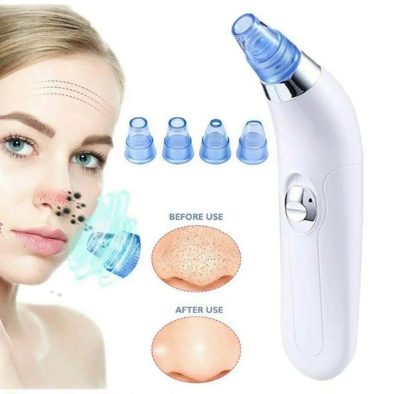 Вакуумный очиститель Derma suction DS Vacuum для профессиональной чистки кожи и пор лица - легкий компактный удобный прибор в использовании + 4 насадки, Белый | Зображення 5