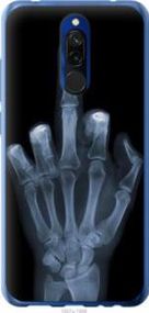 Чохол для Xiaomi Redmi 8 з пластику FCh_062616