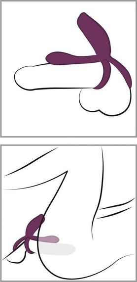 Насадка на член Couples Choice RC Couple's Vib 2 sexstyle | Зображення 2