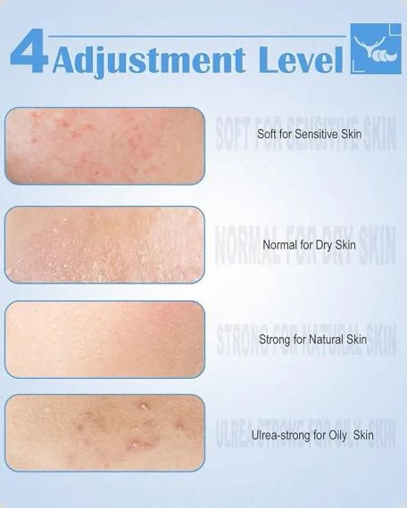 Очисник пор вакуумний Blackhead Remover Y002 Апарат для видалення чорних цяток із 4 режимами та 4 насадками | Зображення 2