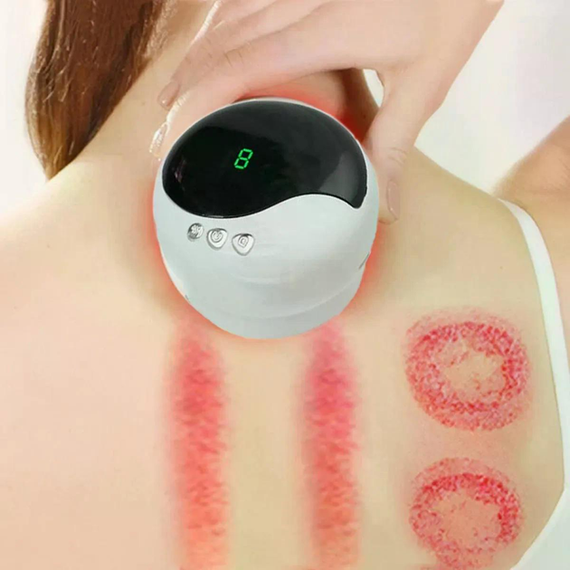 Антицеллюлитный вакуумный массажер Intelligent Cupping Massage, аккумуляторный ручной массажер для всего тела Белый LY-873-White | Зображення 4