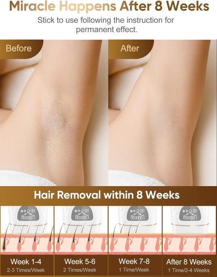Эпилятор IPL Hair Removal DYM-022 с охлаждением, лазерная эпиляция, фотоэпиляция для тела, удаление волос | Зображення 1