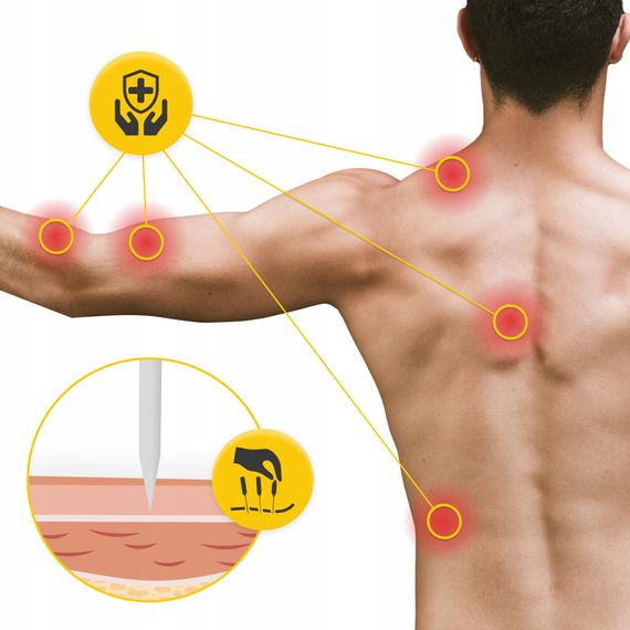 Голки акупунктурні 4FIZJO 0.25 х 30 мм з направляючою 100 шт (P-5905973405065) | Зображення 5