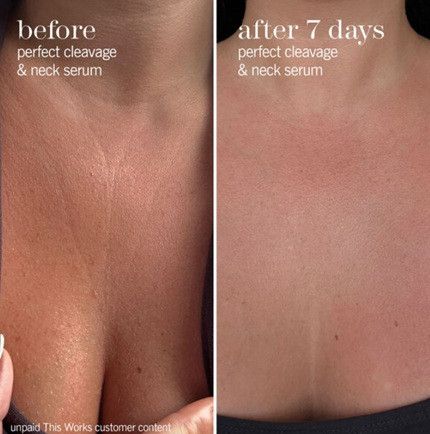 Сироватка для шиї та зони декольте This Works Perfect Cleavage & Neck Serum  20ML | Зображення 4